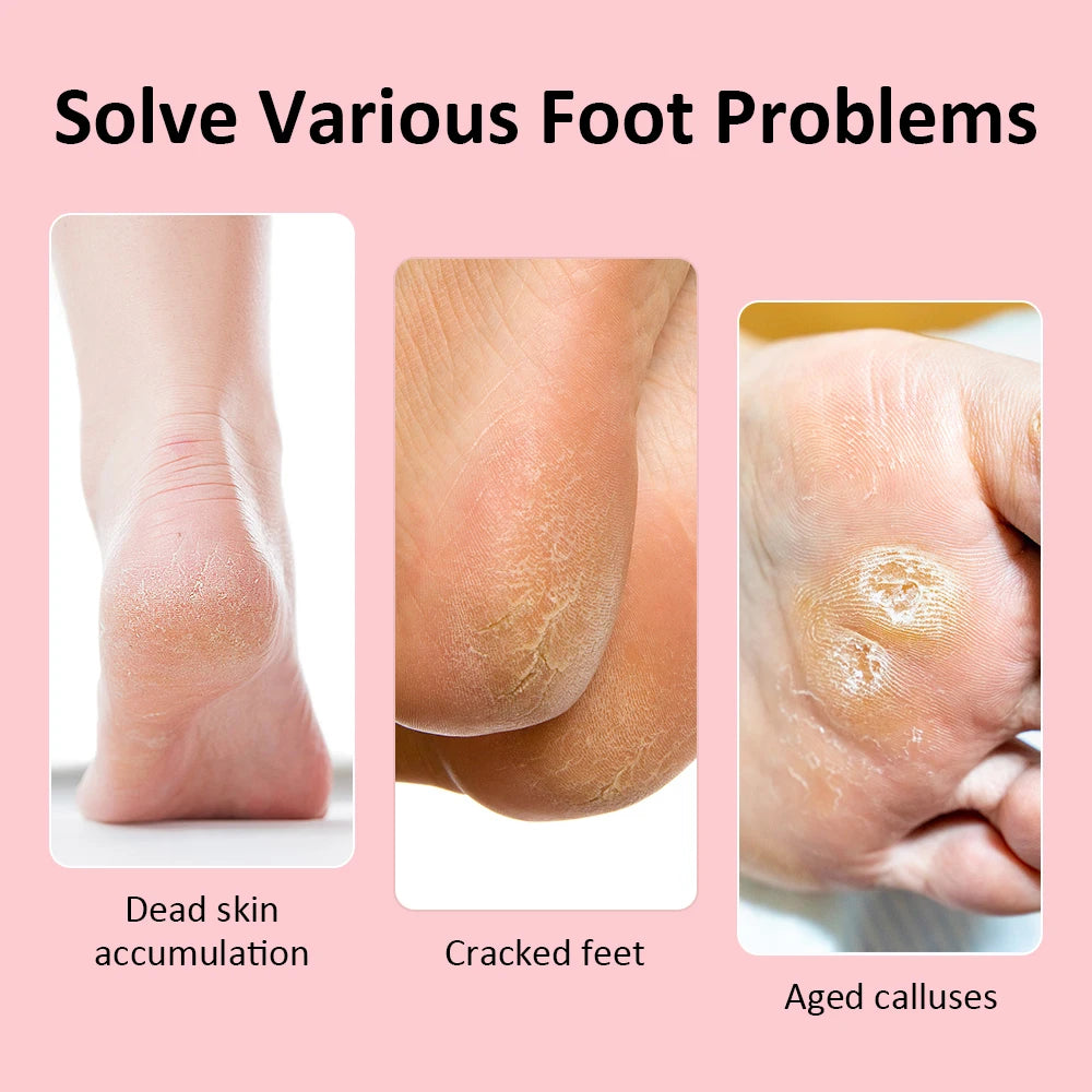 USB Rechargeable Electric Foot Care Callus Remover Nail Grinder Professional Foot Care File with replacement sandpaper tray