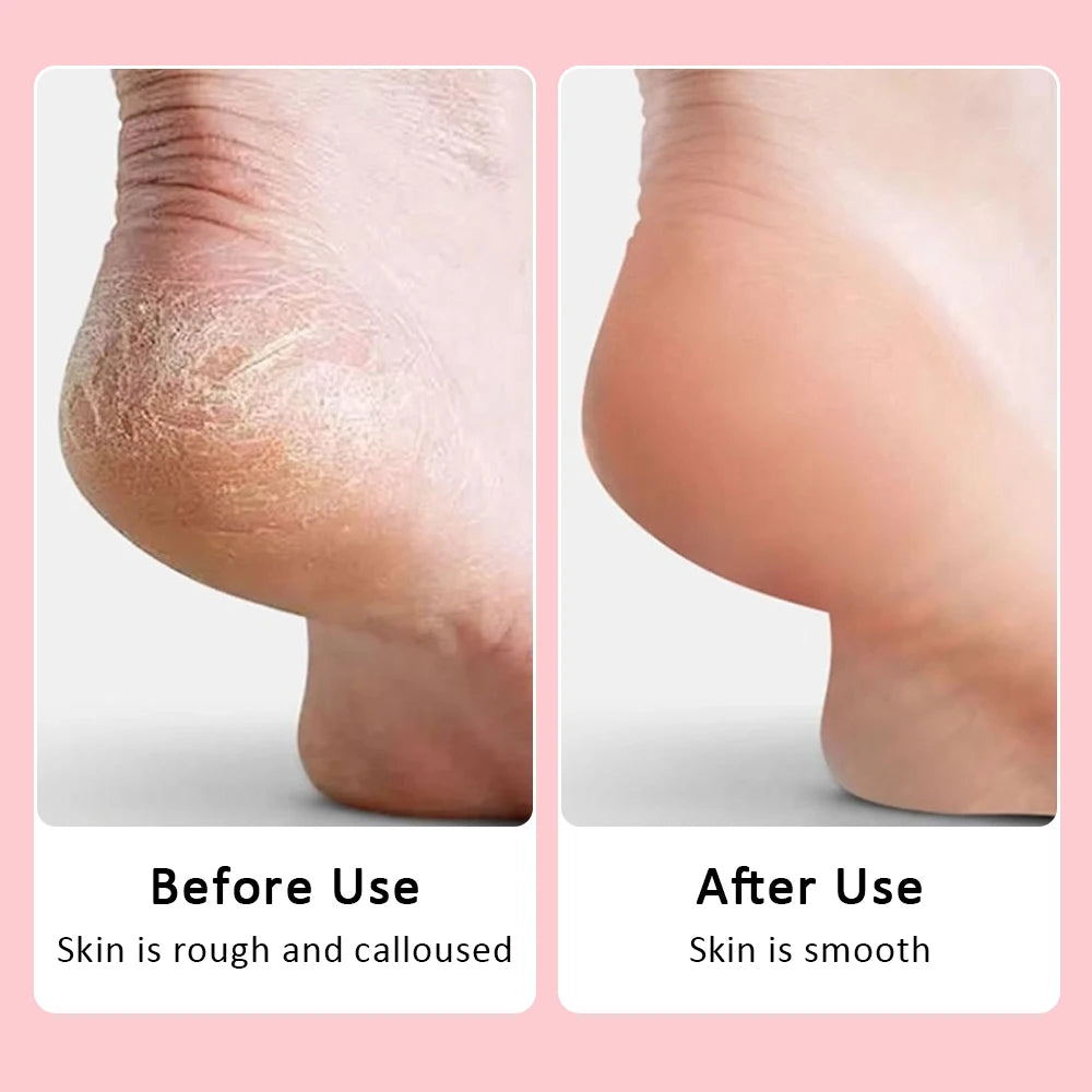 USB Rechargeable Electric Foot Care Callus Remover Nail Grinder Professional Foot Care File with replacement sandpaper tray